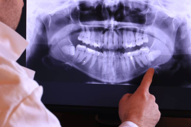 Best After-Hours Emergency Dentist in Wake Village, TX