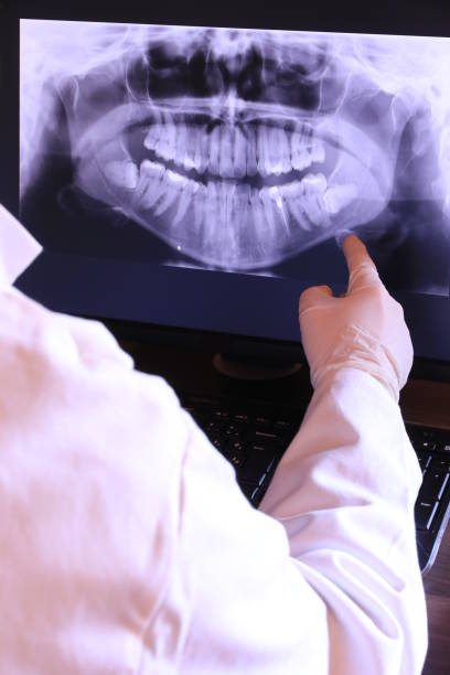 Best Emergency Dental Surgery in Wake Village, TX