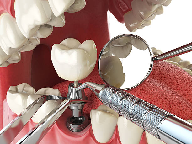 Best Walk-In Emergency Dentist in Wake Village, TX